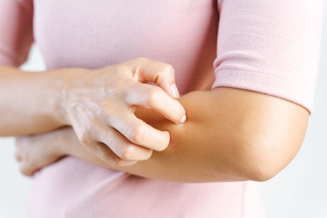 Why you should never use cortisone creams on eczema