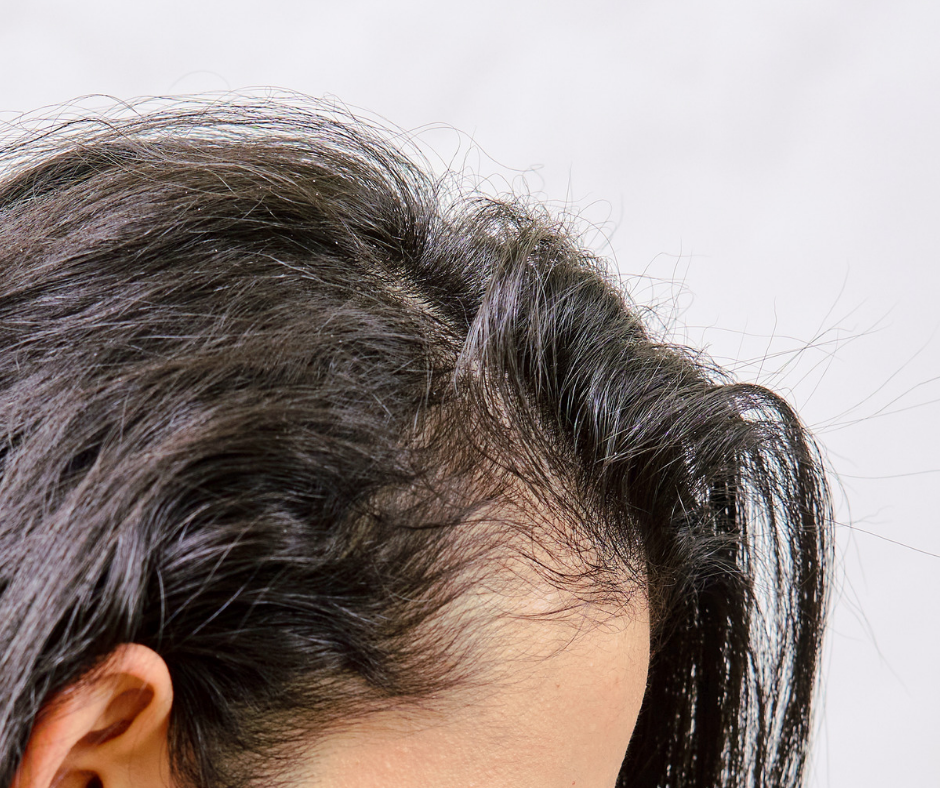 Why a healthy scalp is important for hair growth