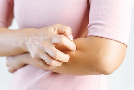 Eczema Treatment