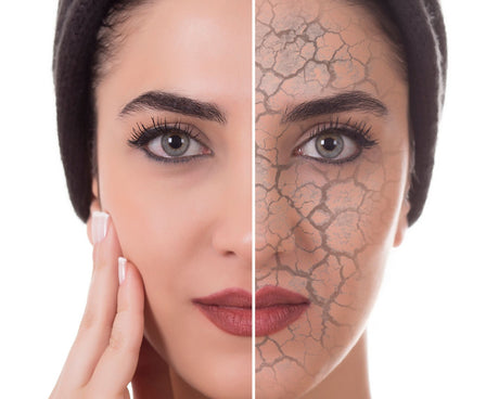 Dry Skin Collection